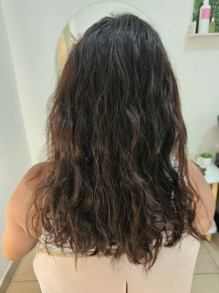 Antes del tratamiento